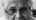 Distressed older woman with advanced dementia