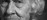  Facial closeup photo from Alzheimer's sufferer